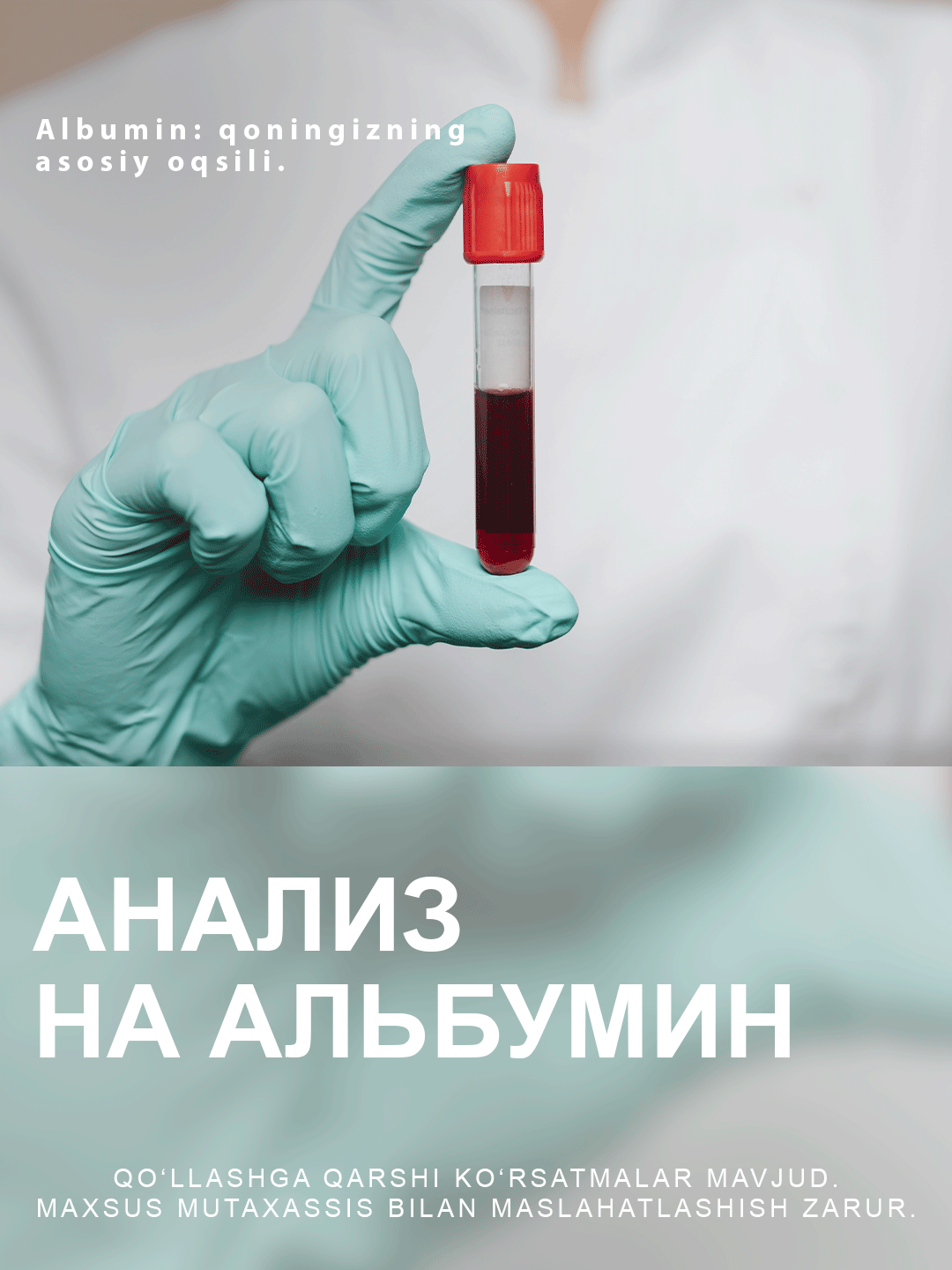 Анализ на альбумин в Swiss Lab